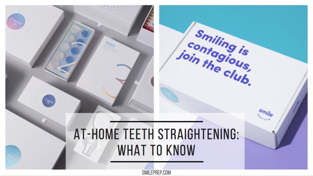 AtHome Teeth Straightening Kits What You Should Know Smile Prep