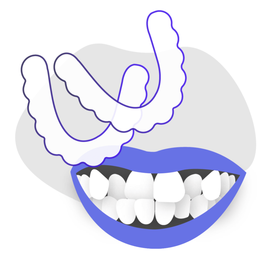 Can at-home clear braces fix crossbite