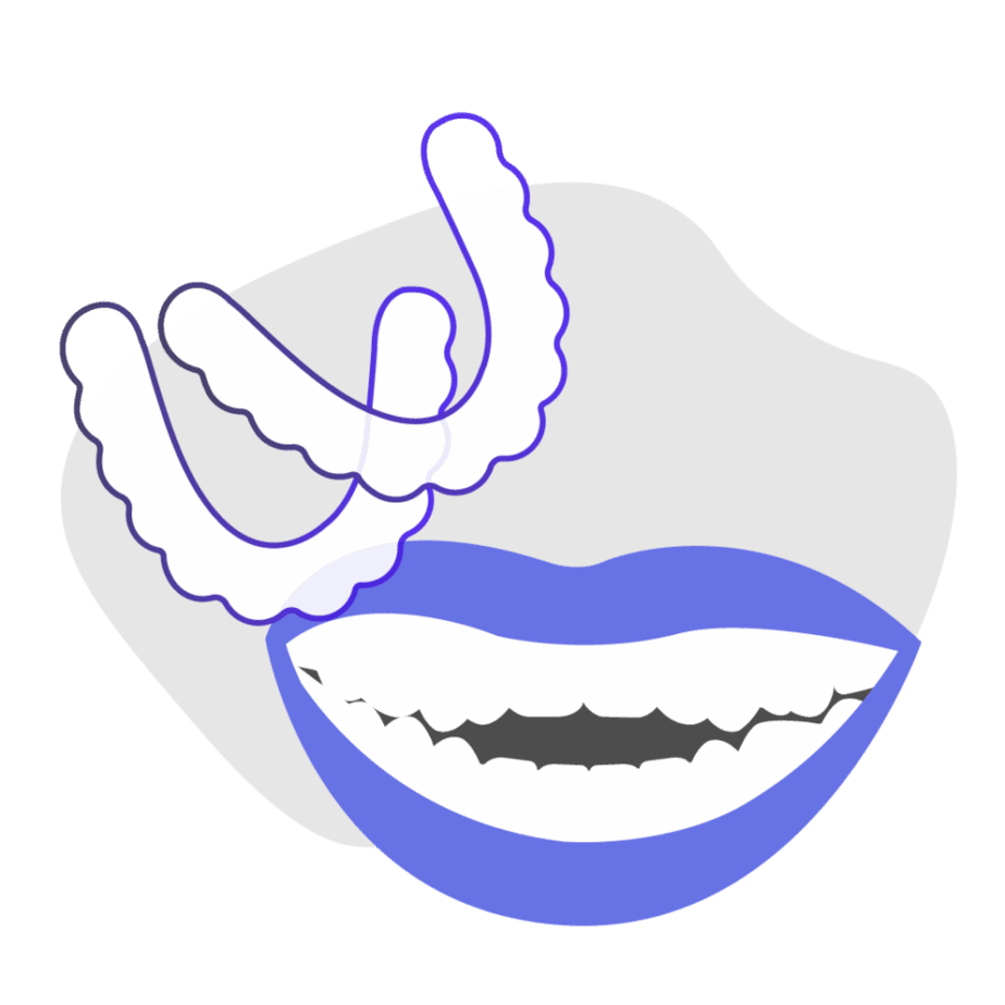 Can at-home aligners treat open bite