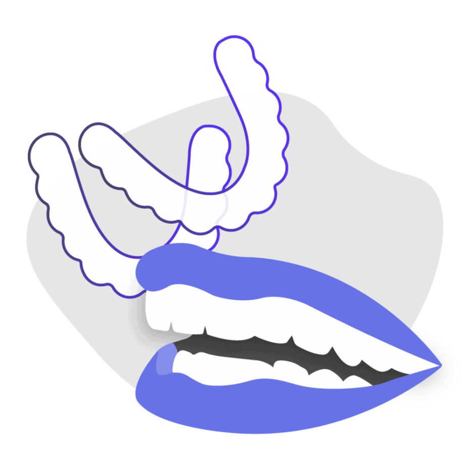 Can at-home aligners fix overbite