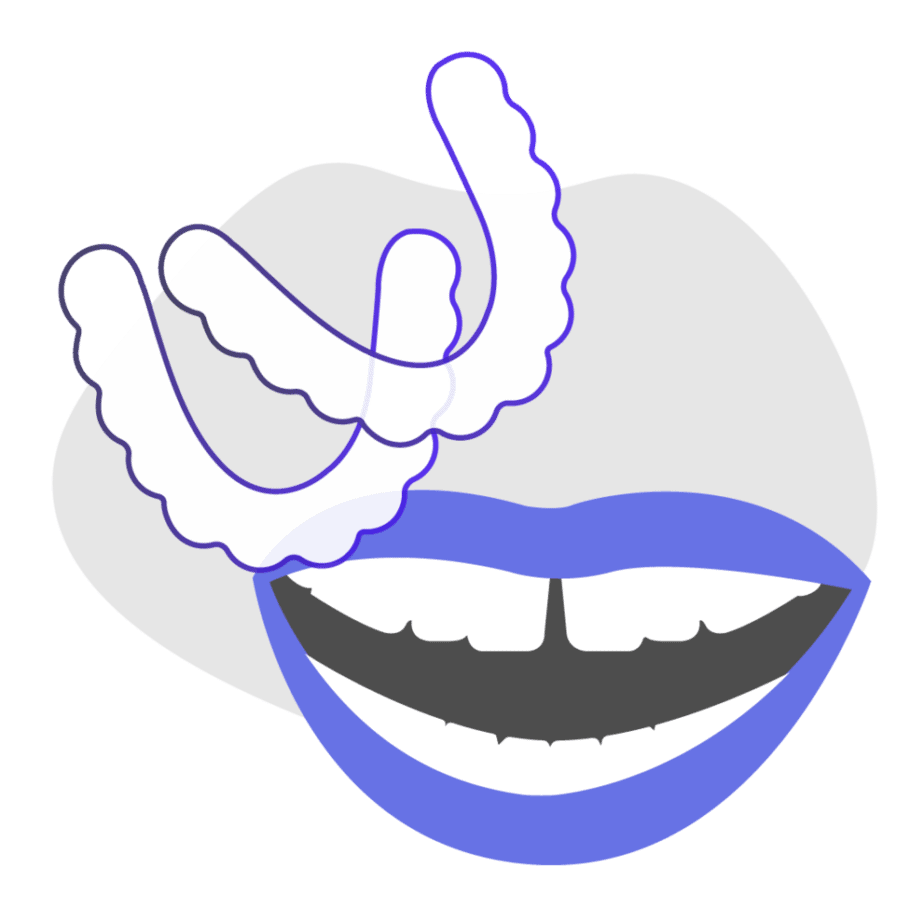 Can at-home clear aligners fix diastema