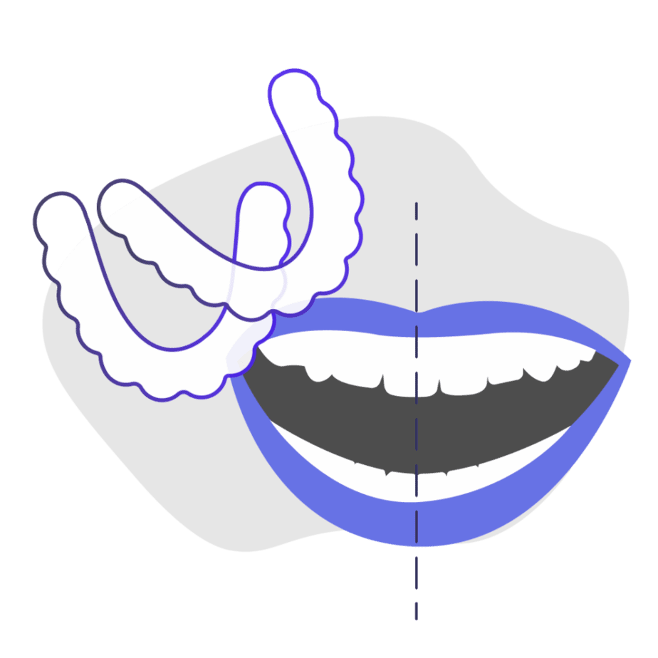 Can at-home clear braces fix midline misalignment