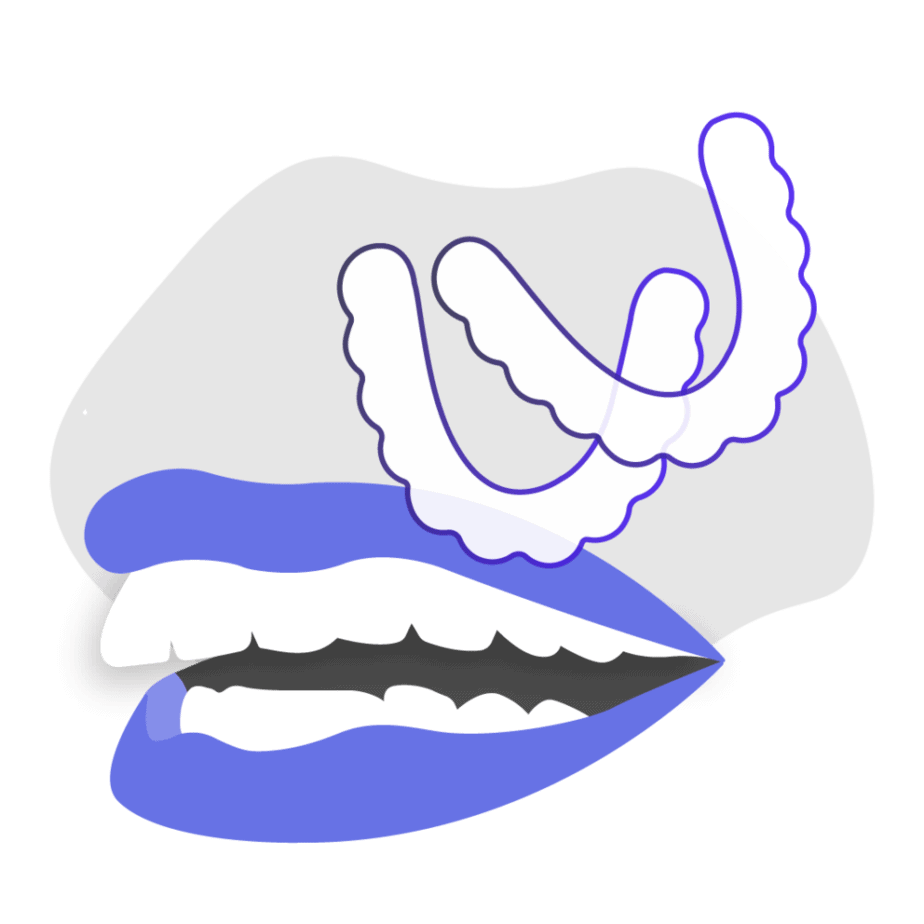 Can at-home clear aligners fix teeth overjet