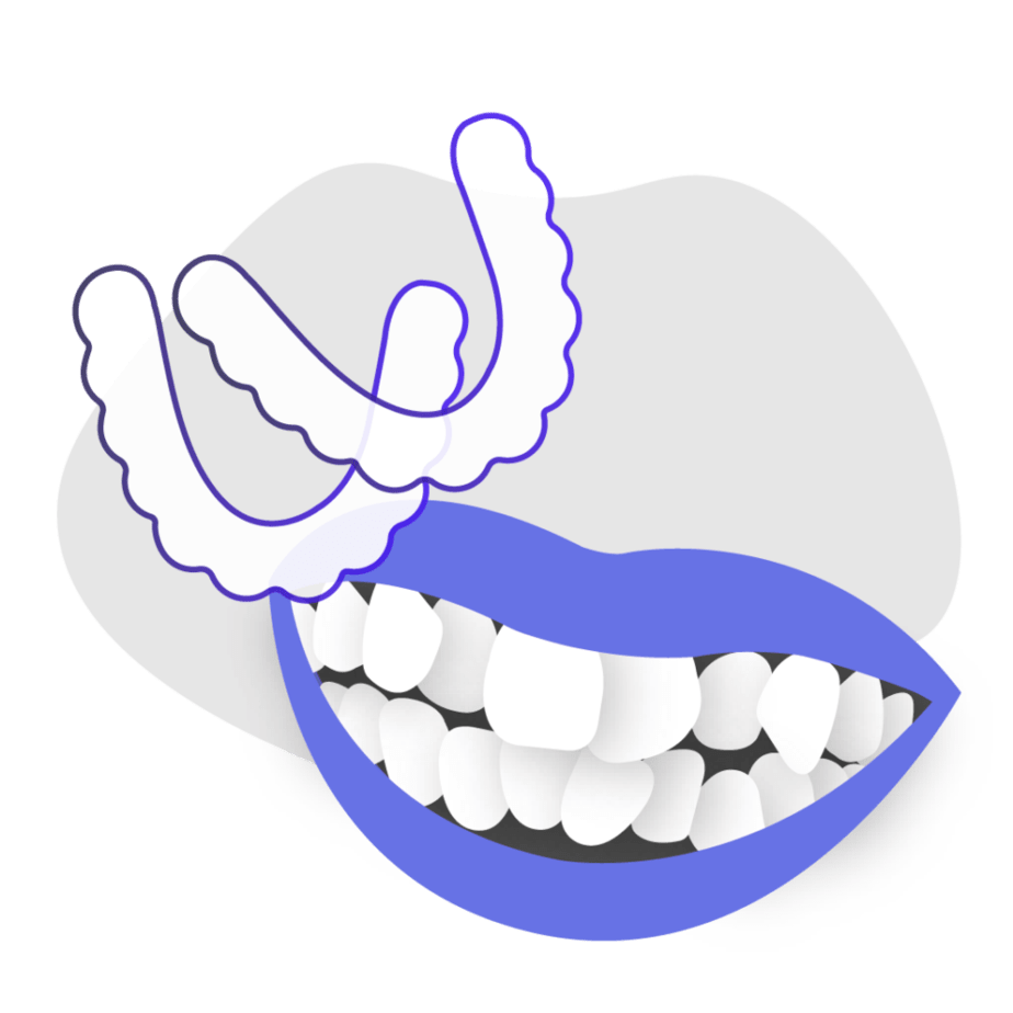 Can At-Home Clear Aligners fix teeth crowding