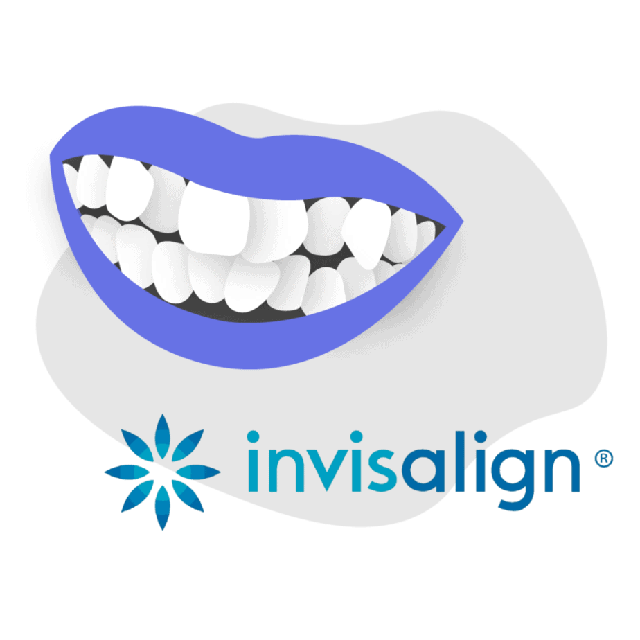 Can Invisalign aligners fix crowded teeth