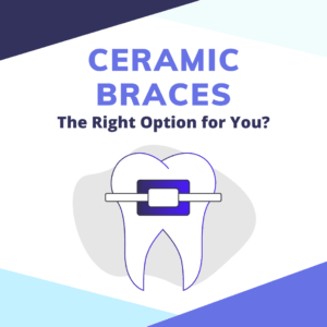 Ceramic Braces: The Right Option for Your Teeth?