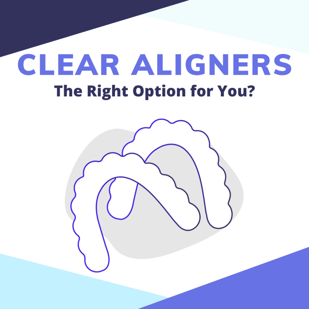 Clear Aligners The Right Option For You?