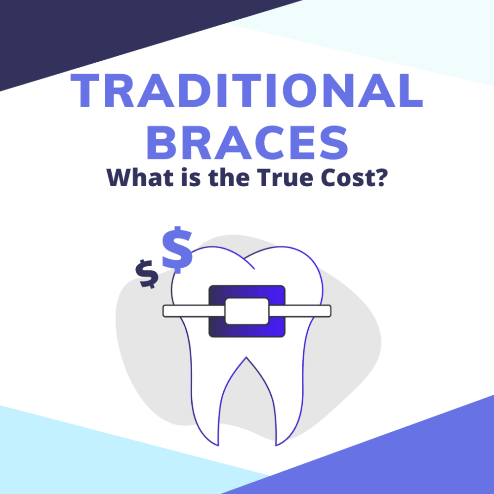 Cost of Traditional Braces