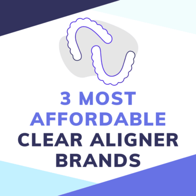 Most affordable clear aligners brands featured image