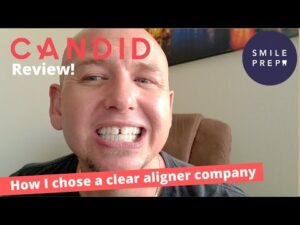 Candid video review