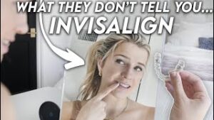 Things I Wish I Knew Before Getting Invisalign