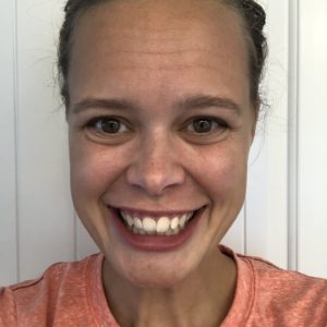 Lauren H. Candid Before Photo Teeth Crowding Overbite