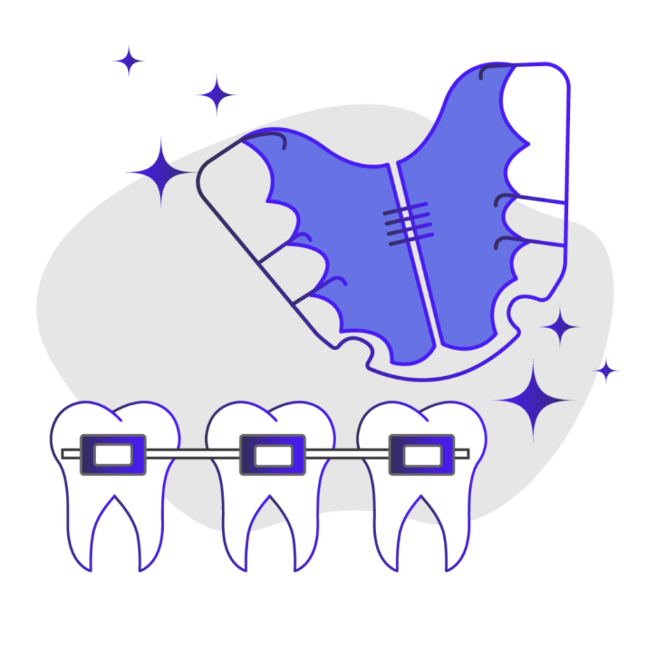 Do you need a retainer after braces image