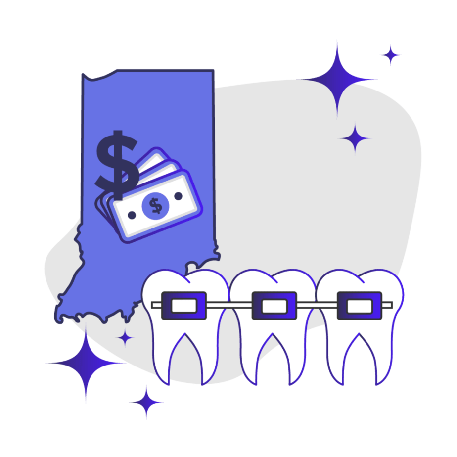 Price of Braces in Indiana Feature Image