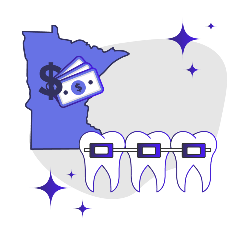 Price of Braces in Minnesota Feature Image