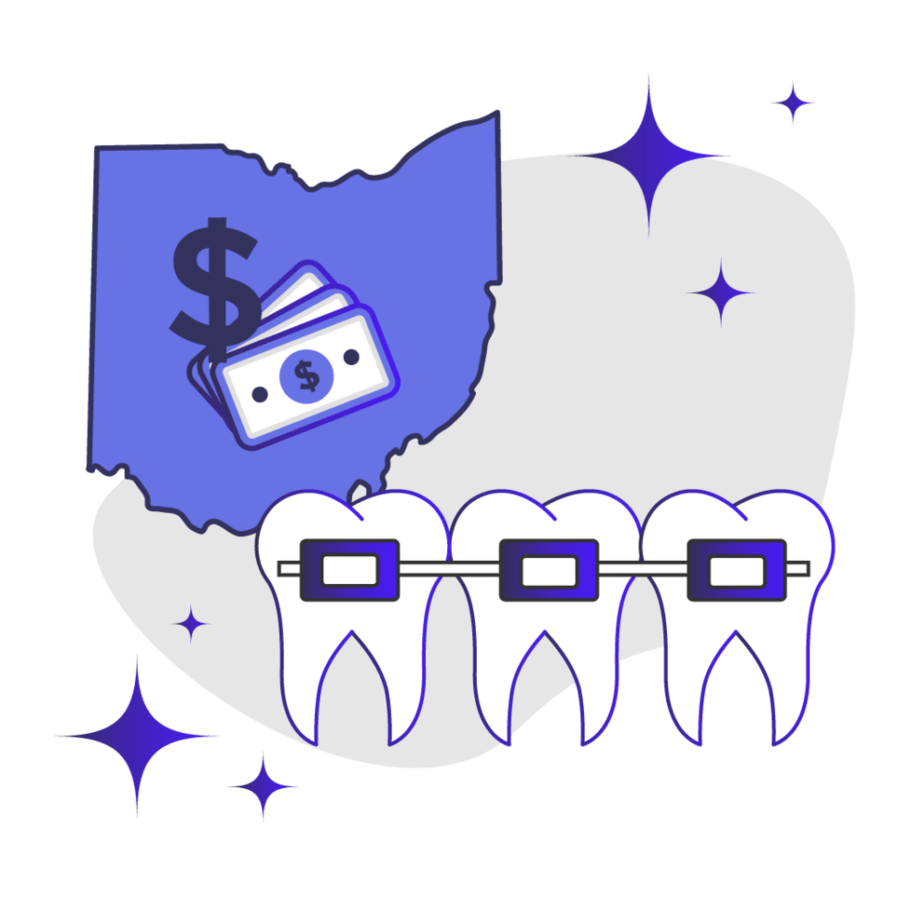 Price of Braces in Ohio Feature Image