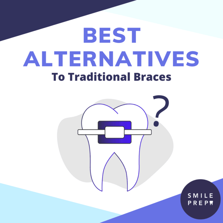 Best alternatives to Braces Guide