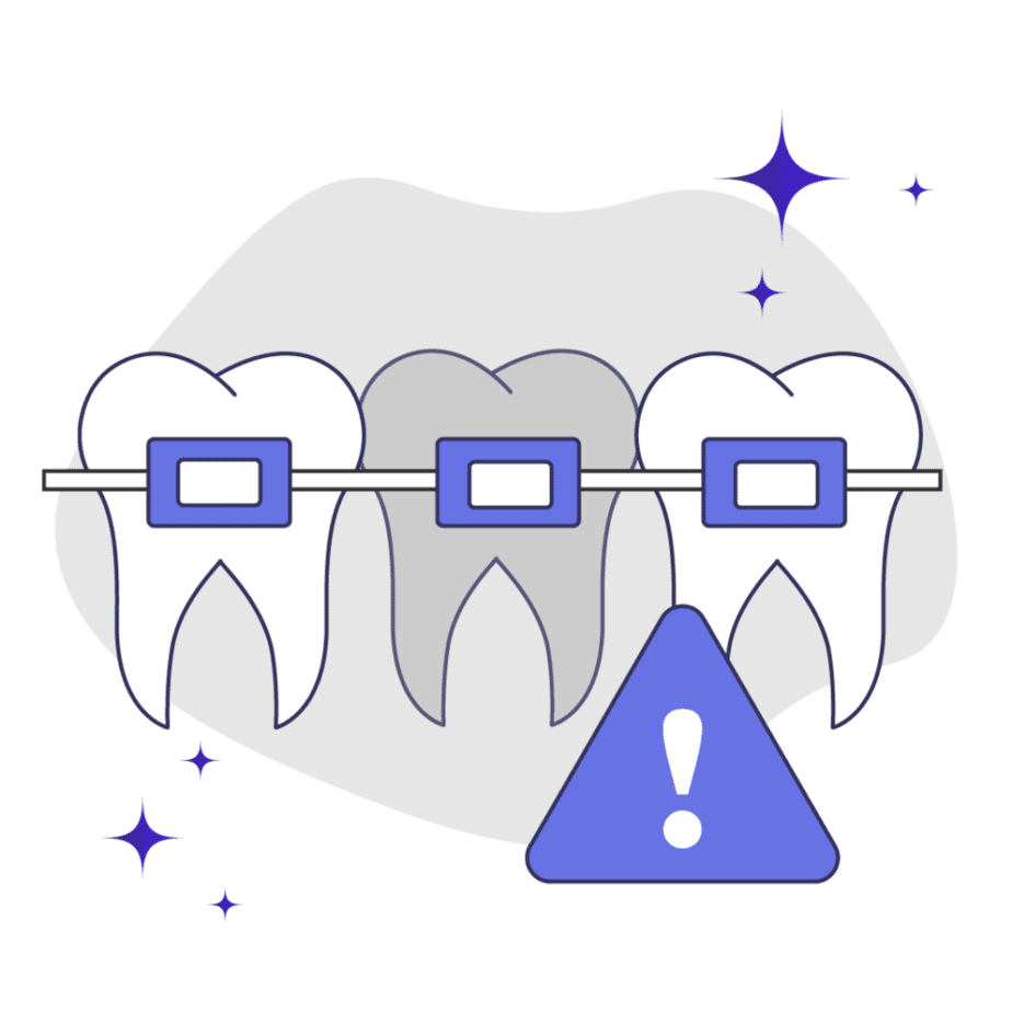 Tooth showing darker color due to braces
