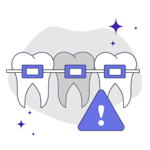 Can Braces Cause Tooth Discoloration?