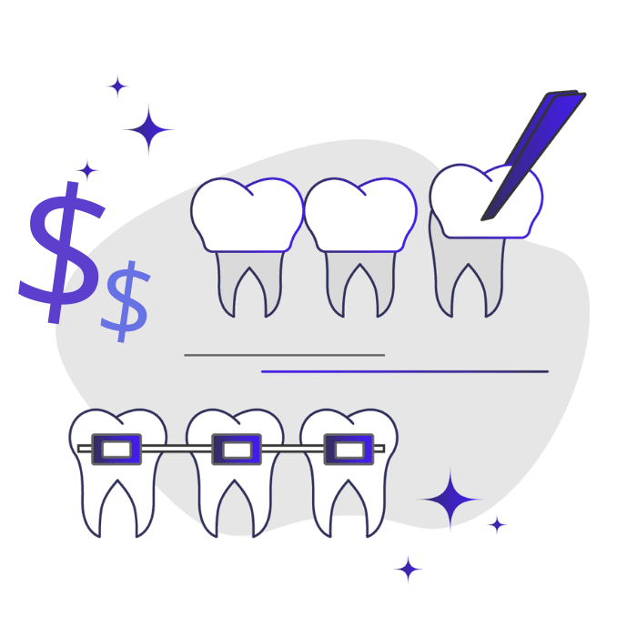 Cost of Veneers vs Braces