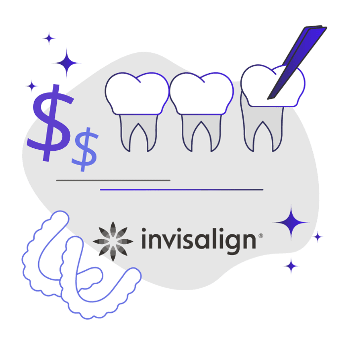 Cost of Veneers vs Invisalign