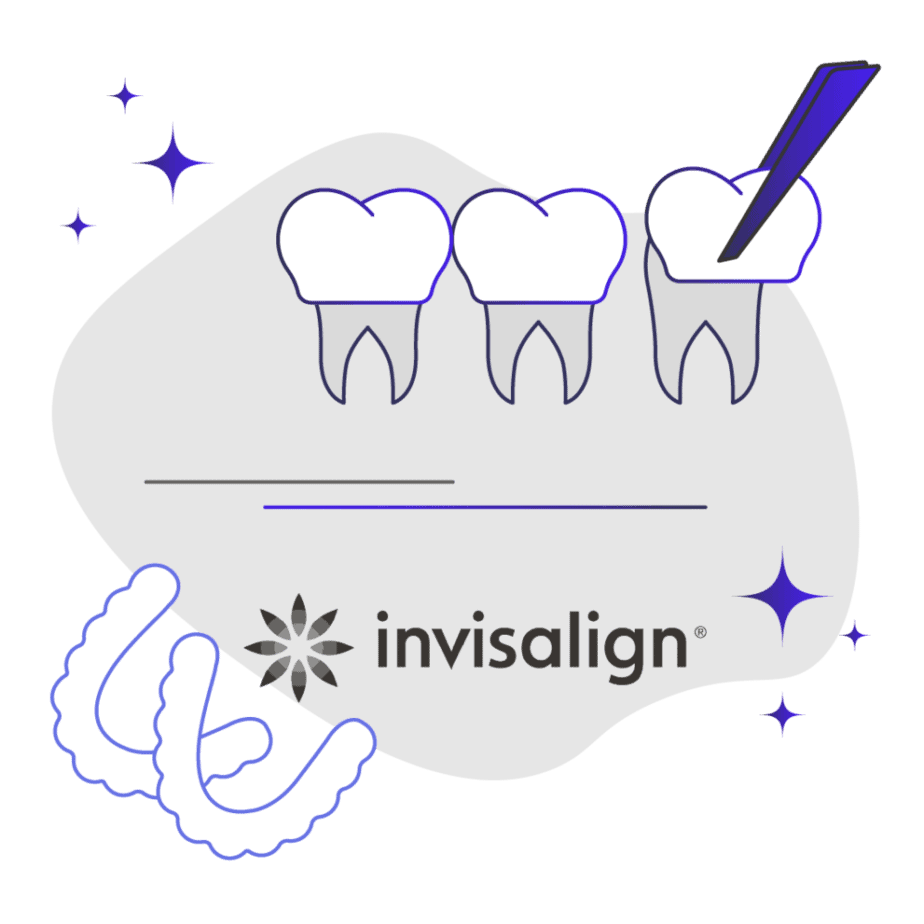 Invisalign aligners vs veneers which is better