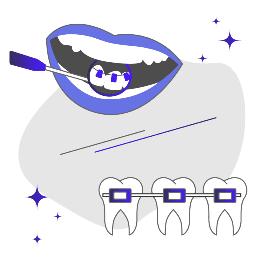 Lingual braces behind teeth vs traditional metal braces comparison