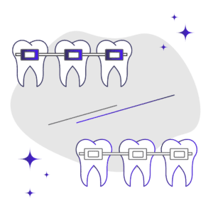 Metal Braces vs. Ceramic Braces: How They Actually Compare
