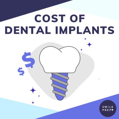 Cost-of-Dental-Implants