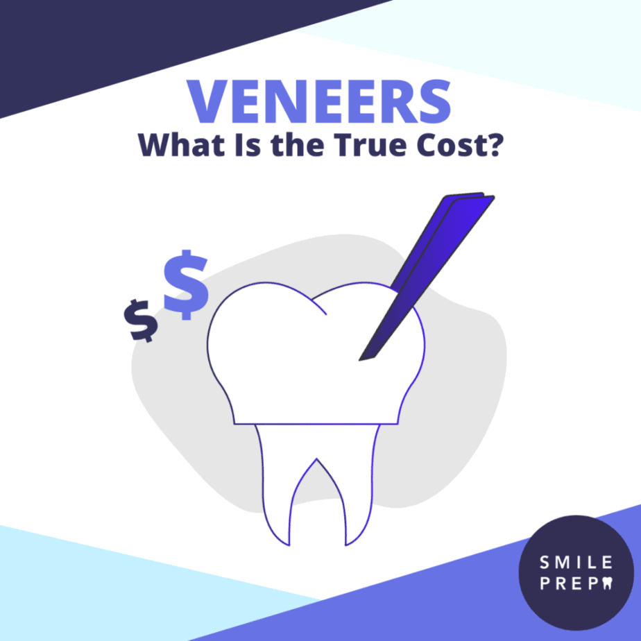 What is the cost of veneers