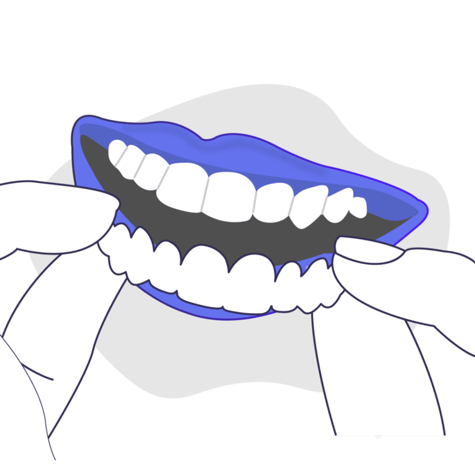 Person putting on temporary veneers