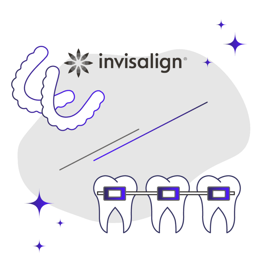 Comparison of Invisalign aligners and metal braces