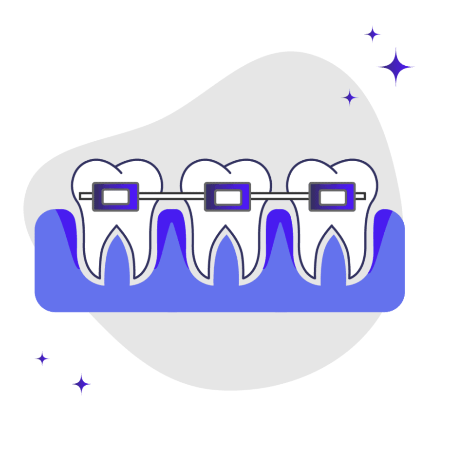 Braces and loose receding gums