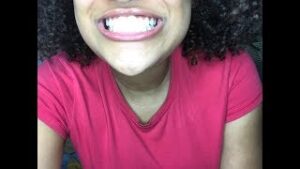 MagicBrite Teeth Whitening Review 1