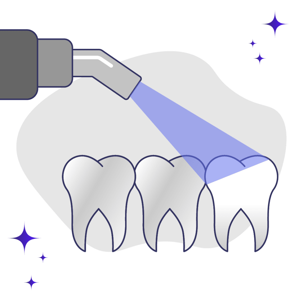Laser Teeth Whitening