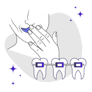 7 Ways To Avoid Lisping During Braces Treatment