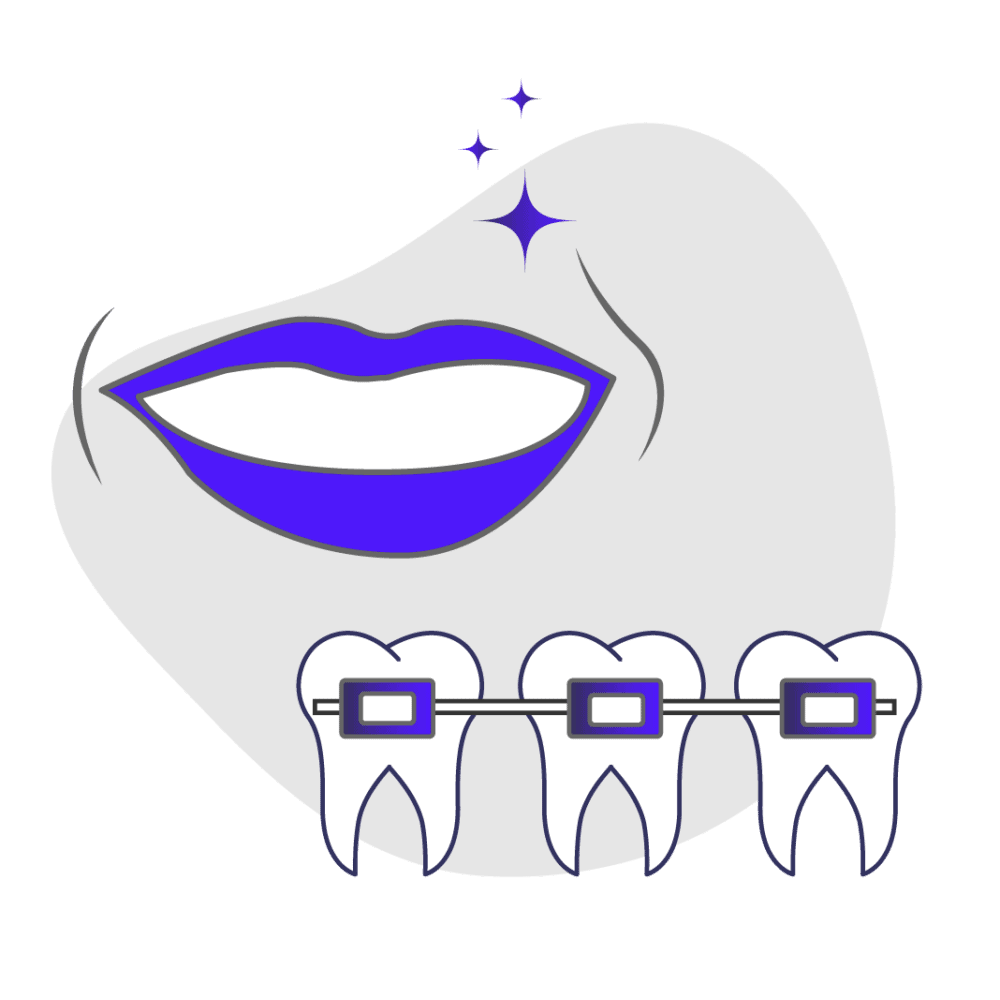 Oral Hygiene Braces