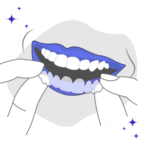 5 Tips for Seating Your Aligners Correctly