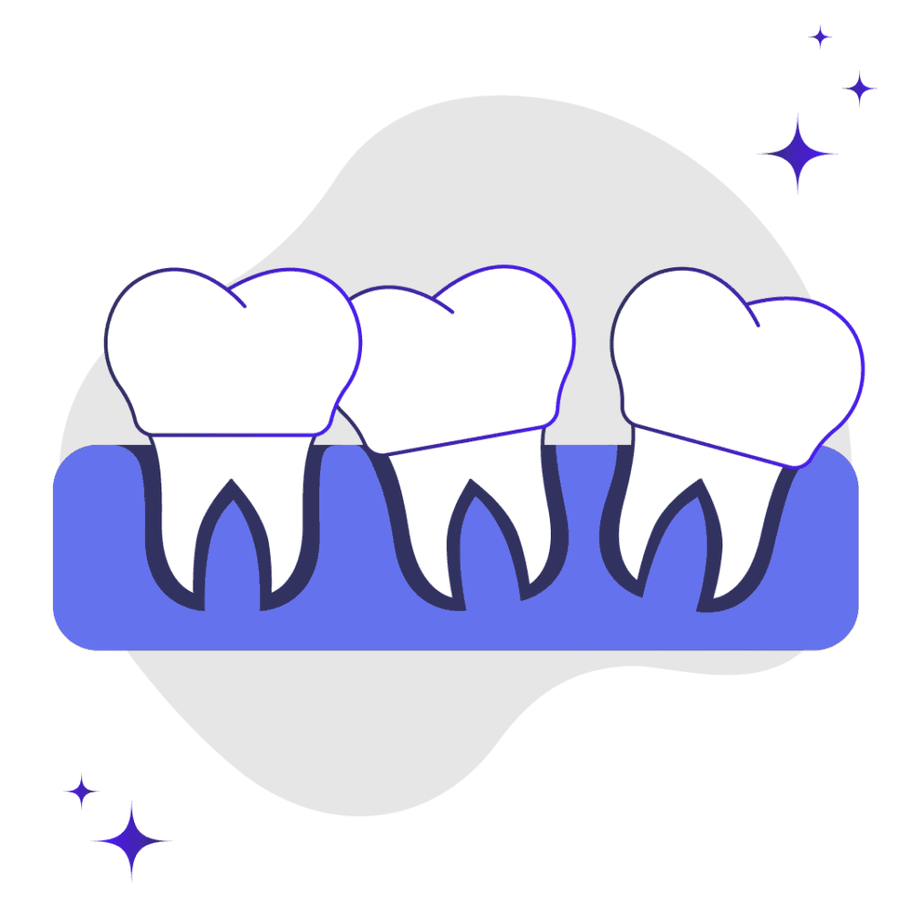 Veneers and Crooked Teeth