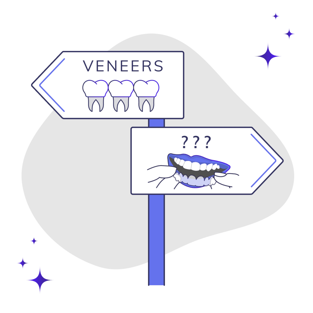 Alternatives to Veneers