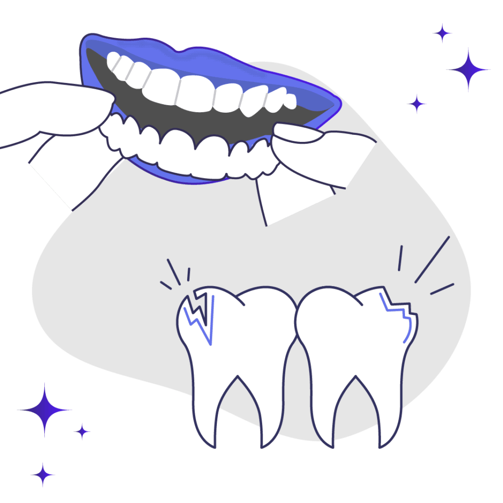 Snap on Veneers for Chipped Teeth