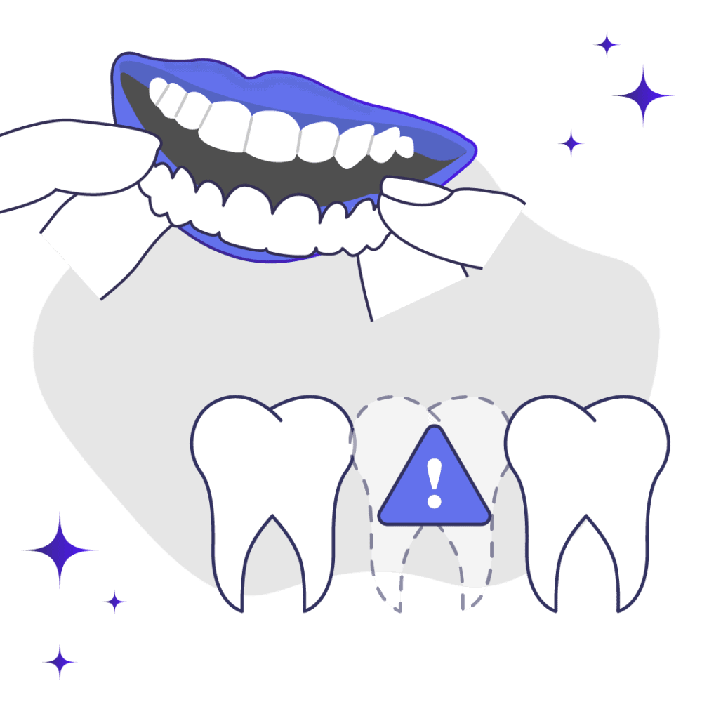 Snap on Veneers for Missing Teeth