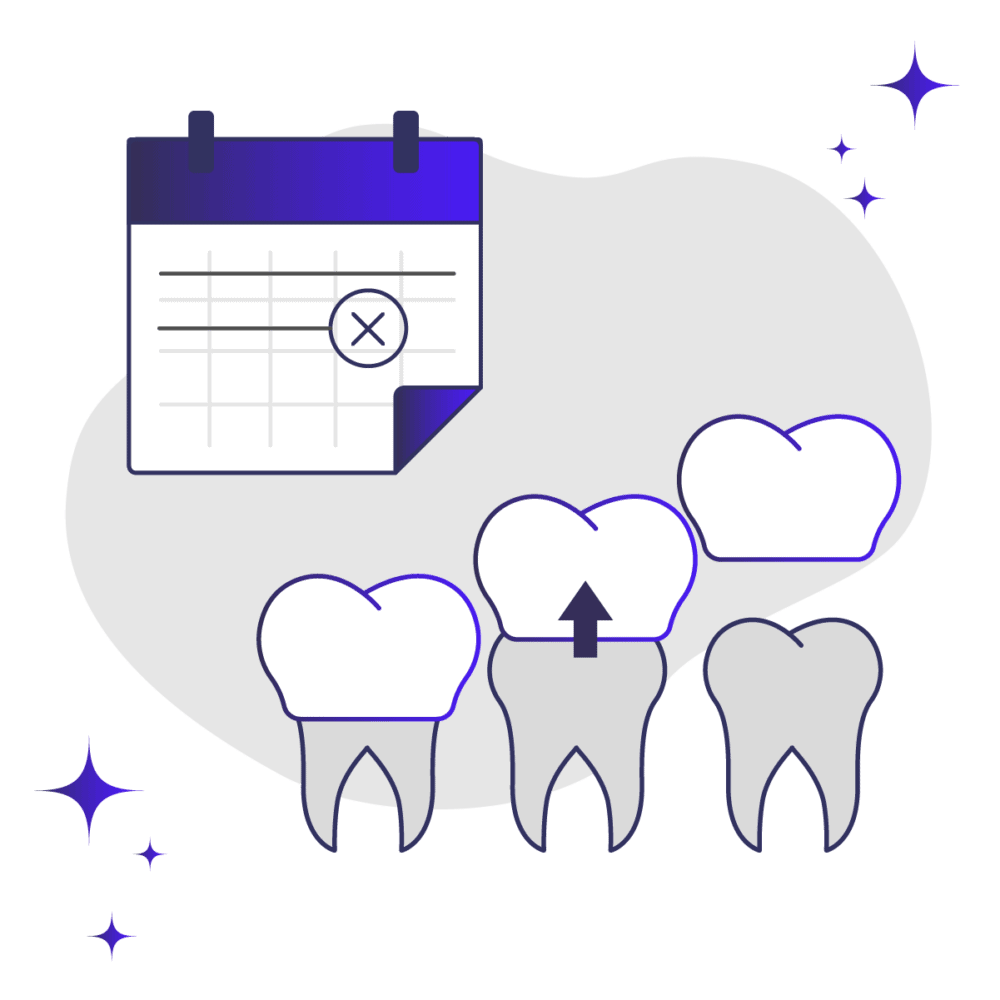 what-happens-after-removing-veneers-smile-prep