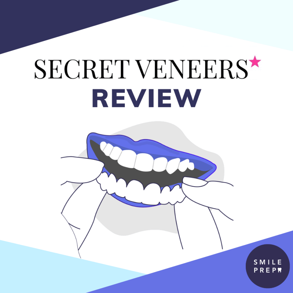 Secret Veneers Slide In Smile Removable Veneers UK Review