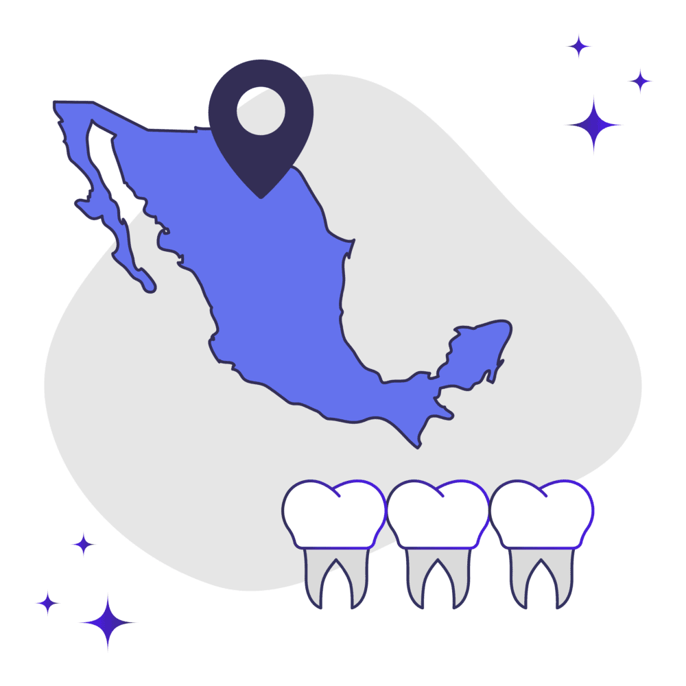 Cost of veneers in Mexico