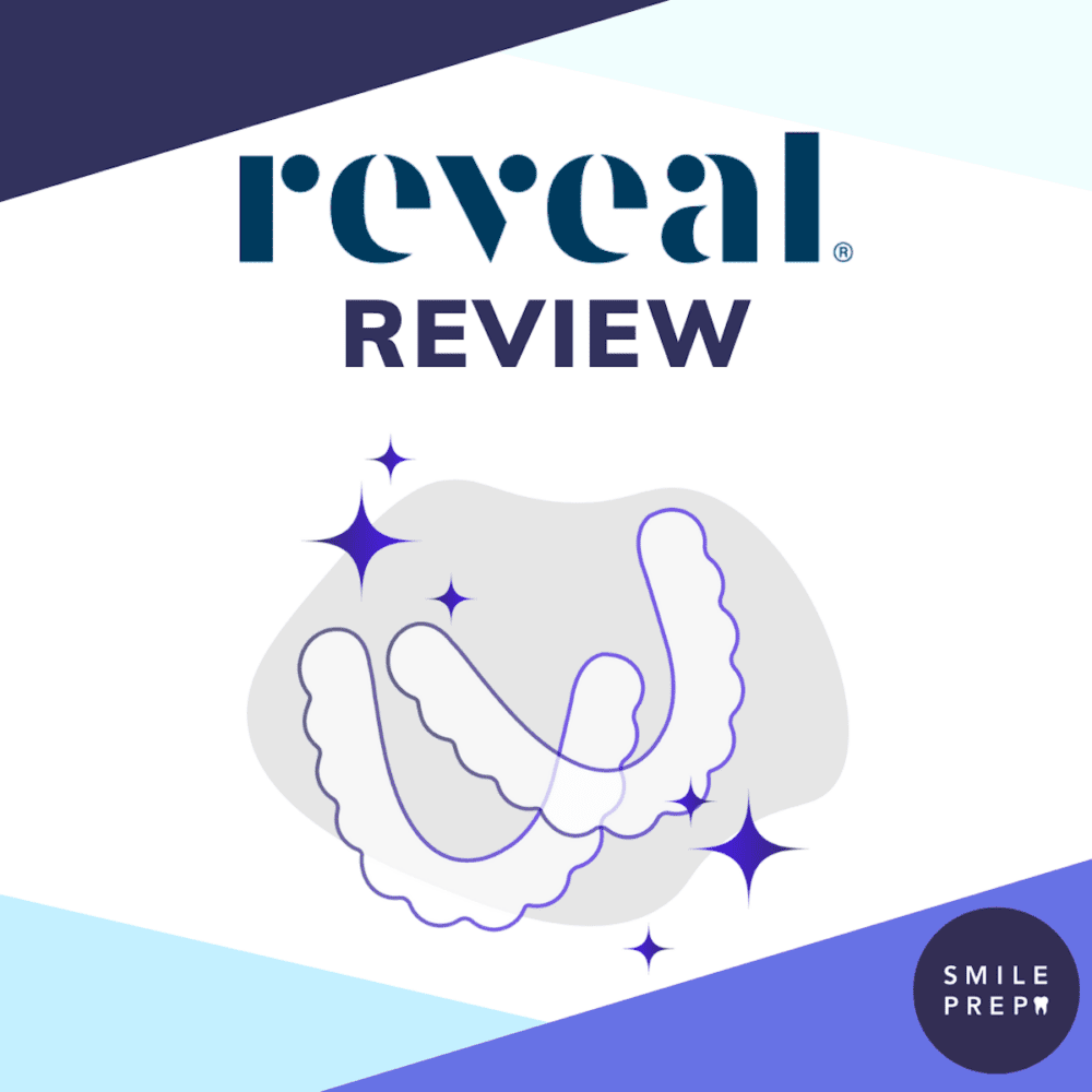 Reveal Clear Aligners Review