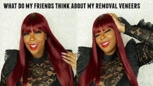 Before-after Veneers