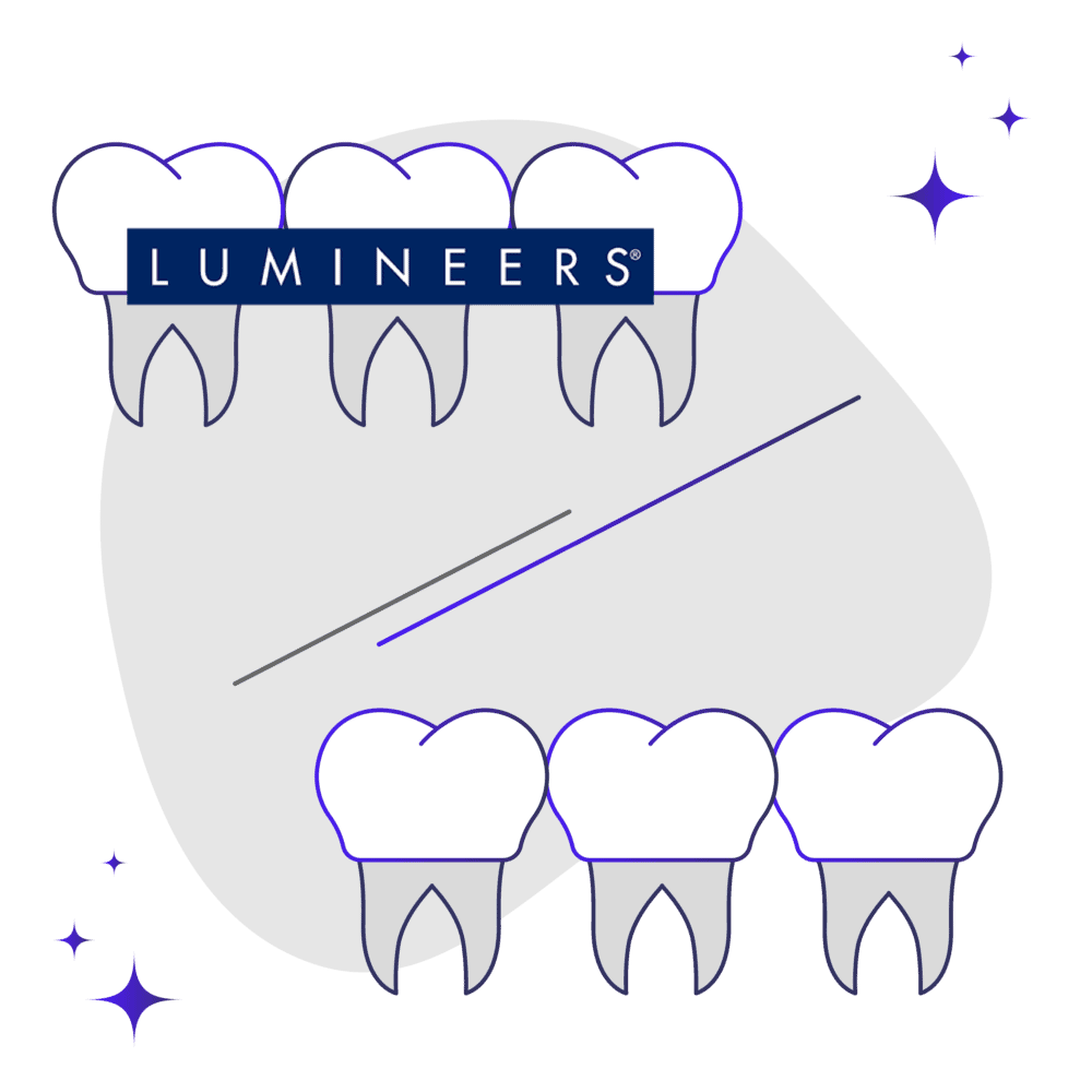 Lumineers v Porcelain Veneers