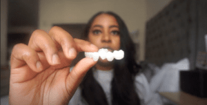 I Got Veneers! I Shiny Smile Review
