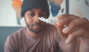 Trusmile veneers review after 2 months